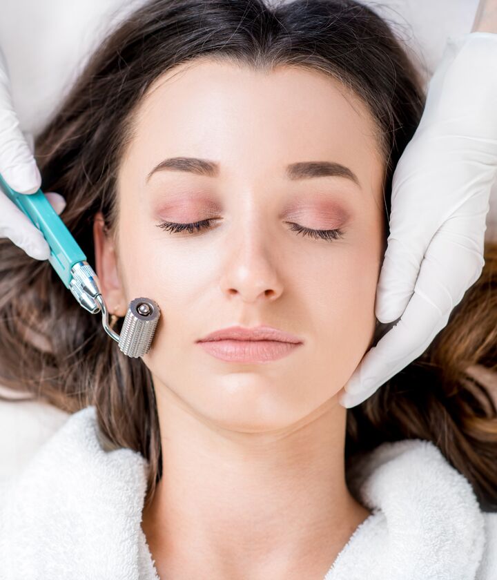 Microneedling bei skin! in Langenhagen